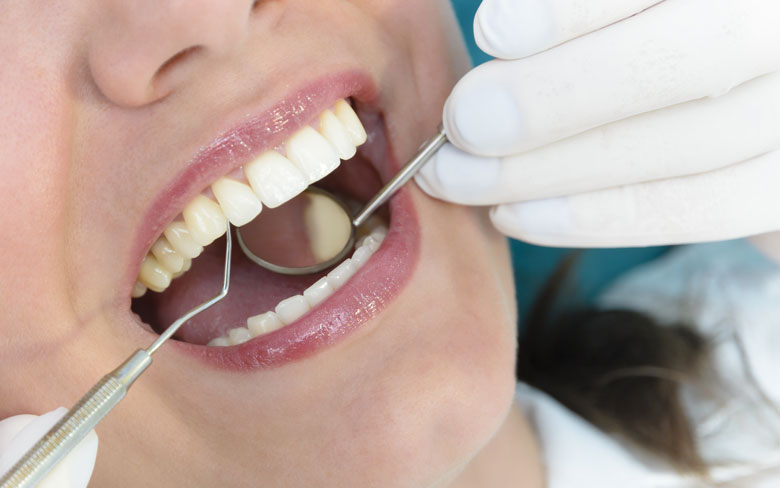 dental-patient undergoing periodontal maintenance Cape Coral FL